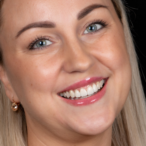 Dream Smile Dental - Crowns Patient