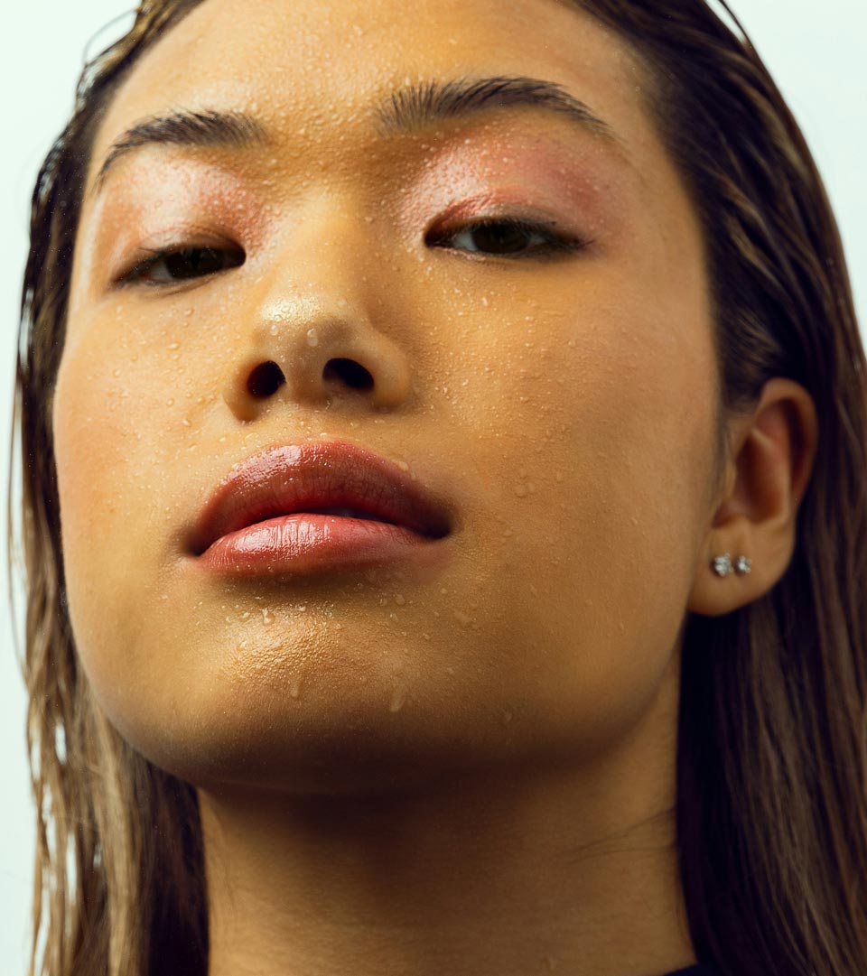 Dream Smile Dental - Excessive Sweating