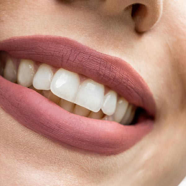 Dream Smile Dental - Hygienist