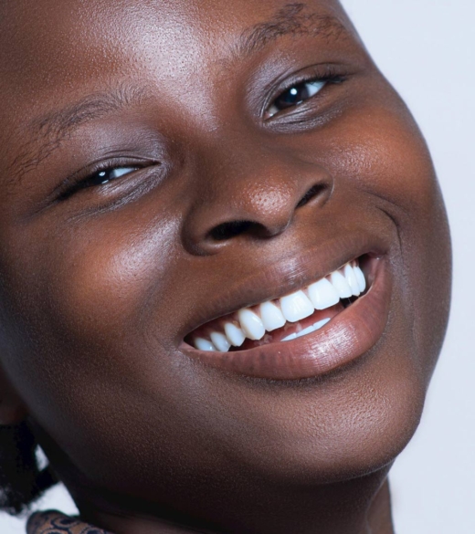 Dream Smile Dental - Inlays - Onlays