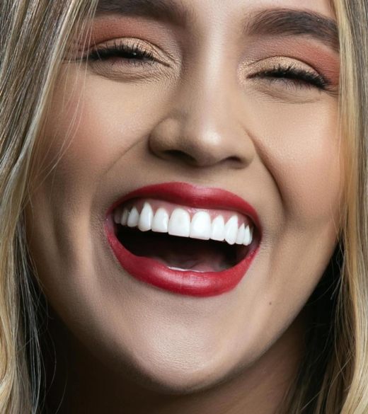 Dream Smile Dental - Laser Gum Contouring