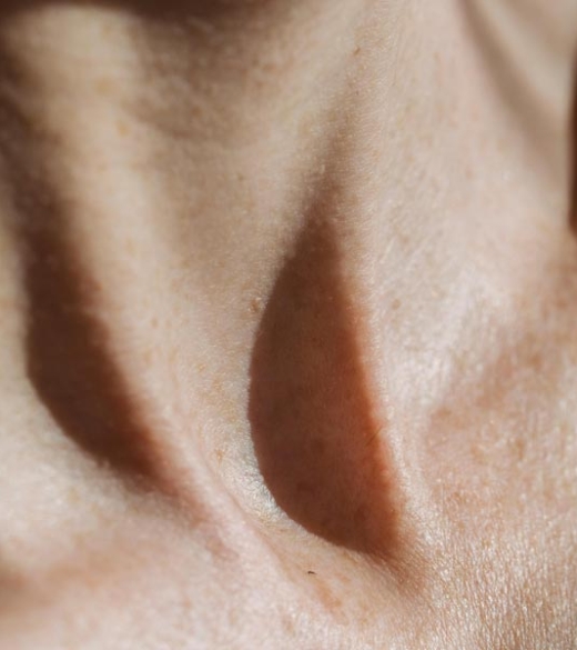 Dream Smile Dental - Skin sagging