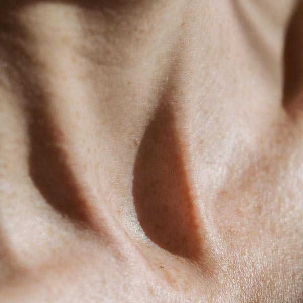 Dream Smile Dental - Skin sagging