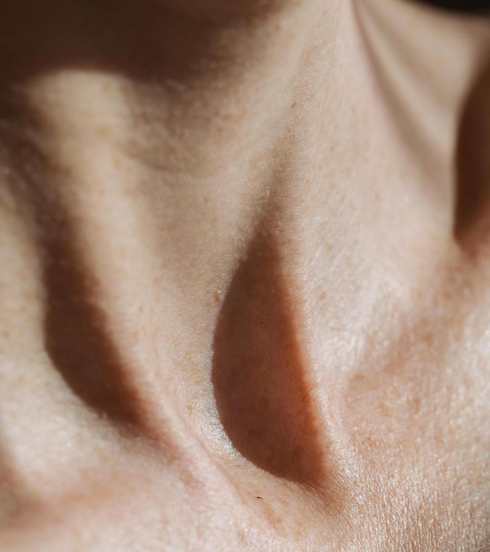 Dream Smile Dental - Skin sagging