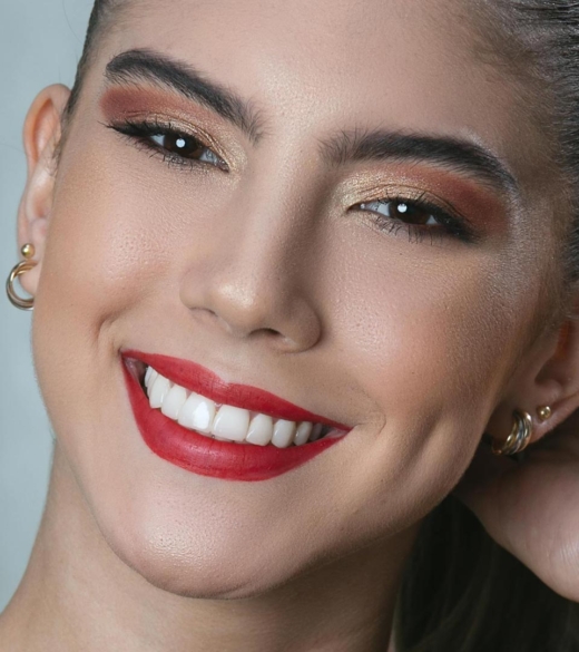 Dream Smile Dental - Tooth Coloured Fillings