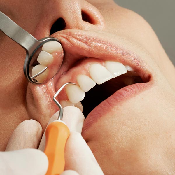 Dream Smile Dental - Why Choose First Full Examination