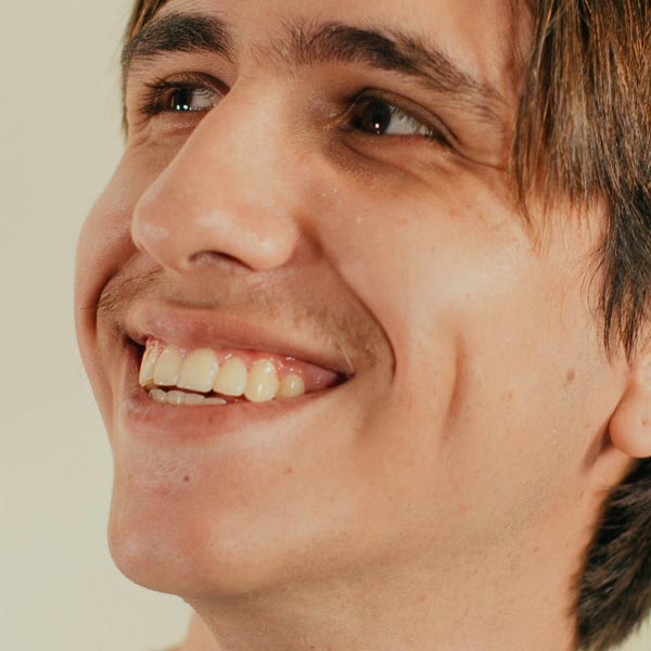 Dream Smile Dental - Why Choose Gum Bleaching (Gum Depigmentation)