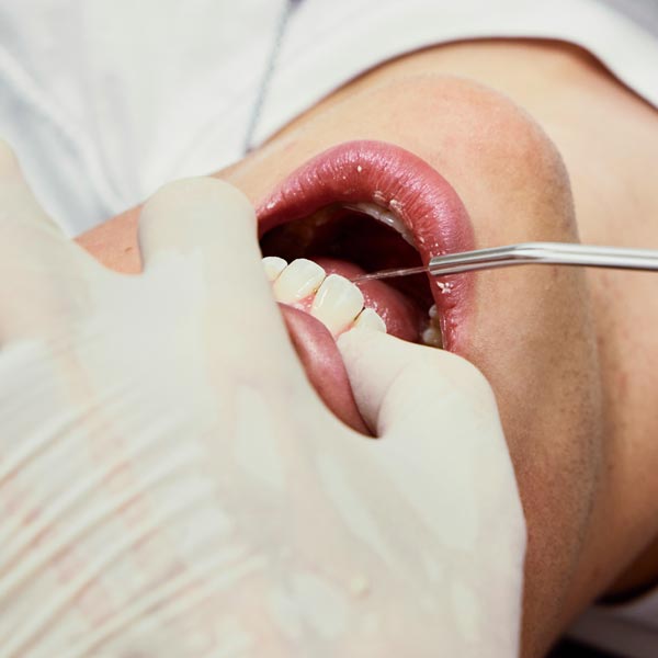 Dream Smile Dental - Why Choose Hygienist