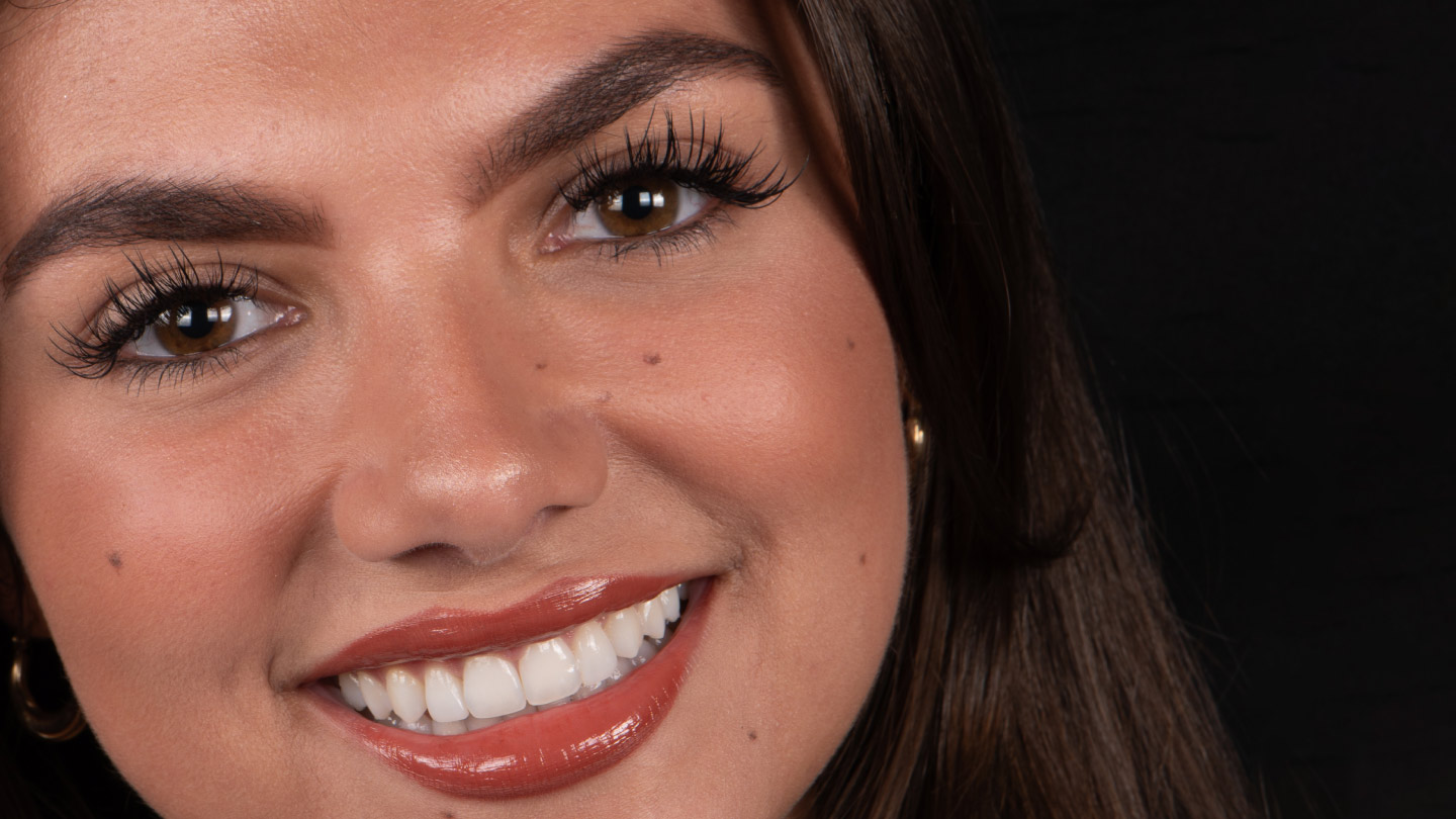 Dream Smile Dental - Smile Biometrics Design your smile with precision and purpose