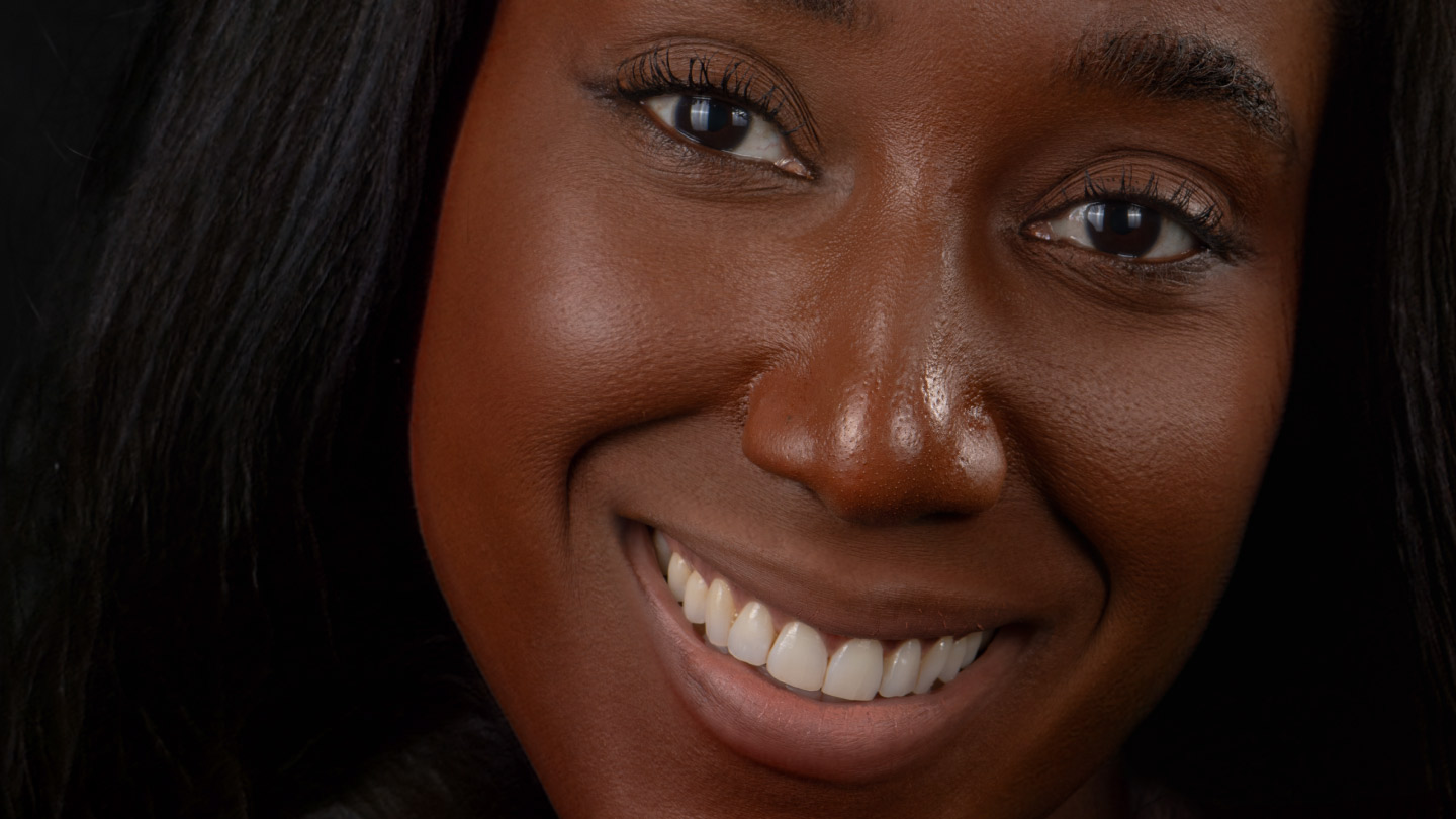 Dream Smile Dental - Smile Gallery