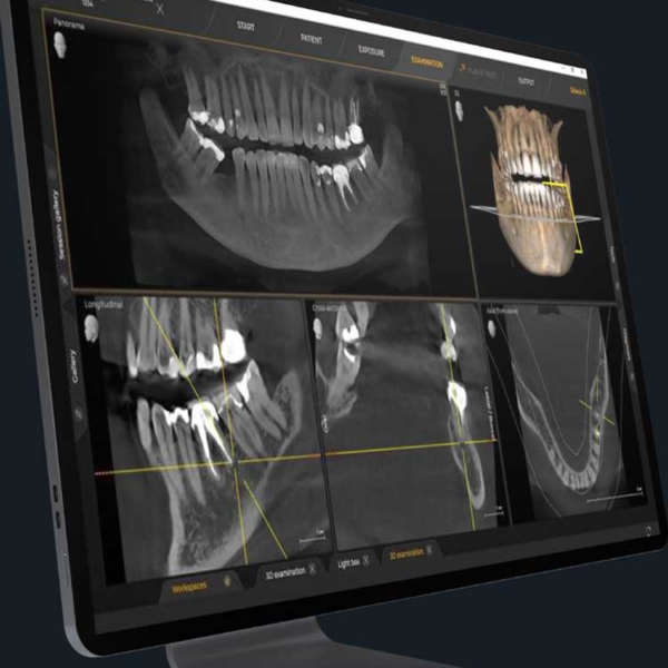 Dream Smile Dental - 3D Imaging with CBCT Technology