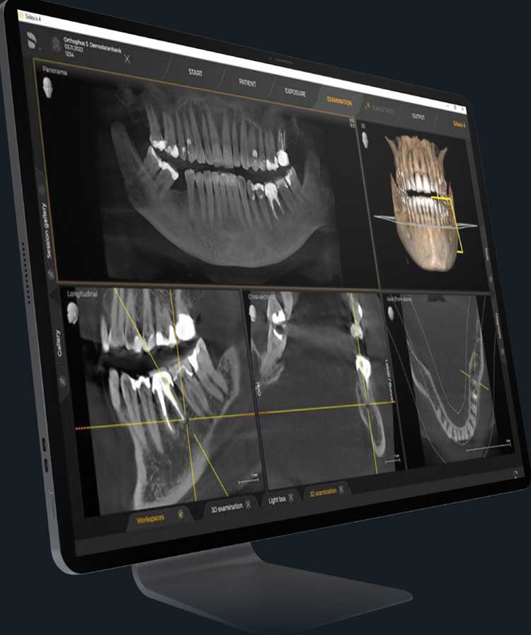Dream Smile Dental - 3D Imaging with CBCT Technology