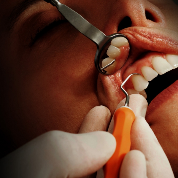 Dream Smile Dental - Common Causes