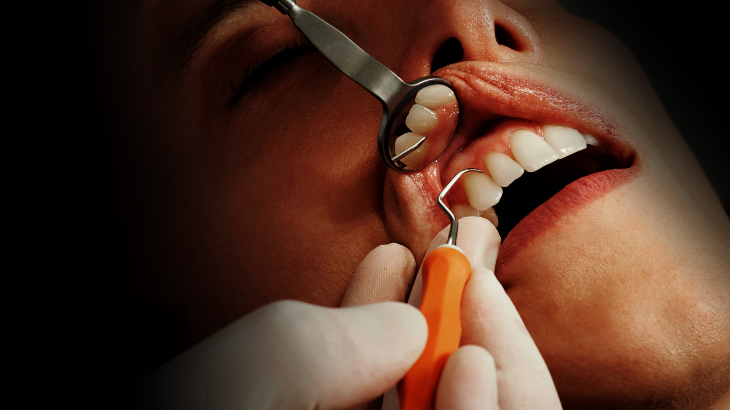 Dream Smile Dental - Common Causes