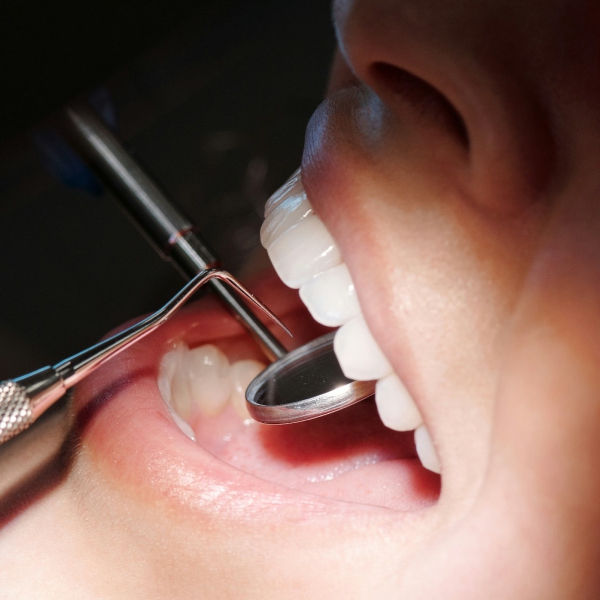 Dream Smile Dental - Dental Concerns