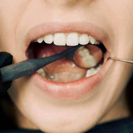 Dream Smile Dental - Regular Dental Check-Ups