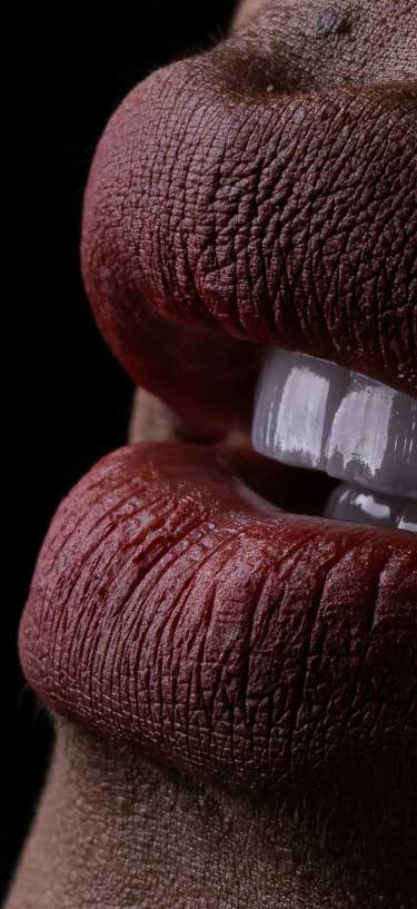 Dream Smile Dental - Treatment Benefits