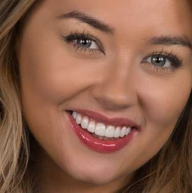 Dream Smile Dental - Who Can Use Invisalign