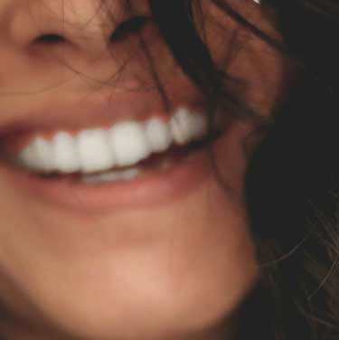 Deam Smile Dental - 5 Year Guarantee