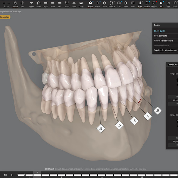 Dream Smile Dental - Comprehensive Gum, Bone, and Orthodontic Analysis