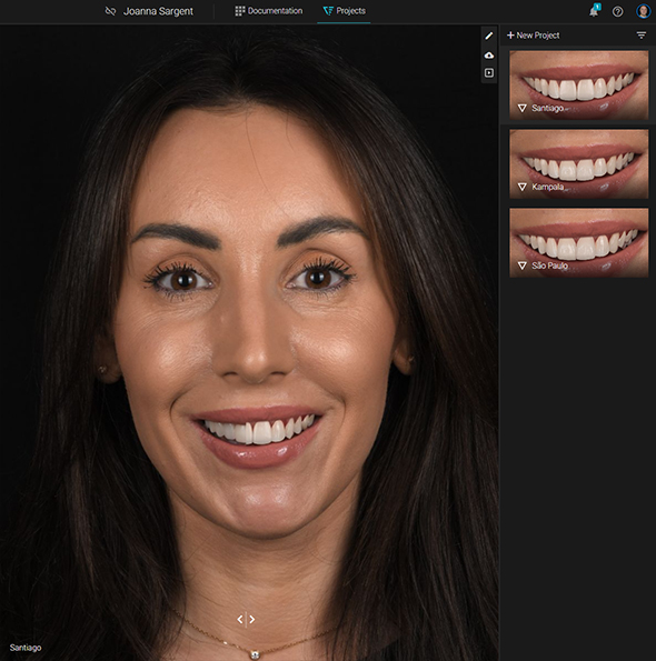 Dream Smile Dental - Smile Makeover