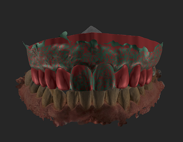 Dream Smile Dental - Smile Makeover