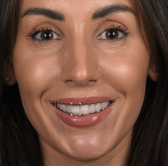 Dream Smile Dental - Smile Makeover