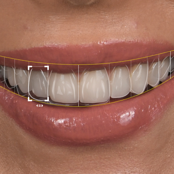 Dream Smile Dental - Smile Makeover