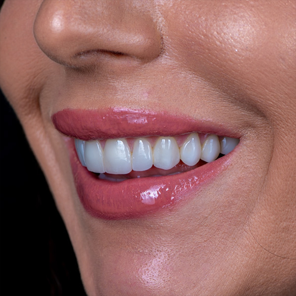 Dream Smile Dental - Smile Makeover